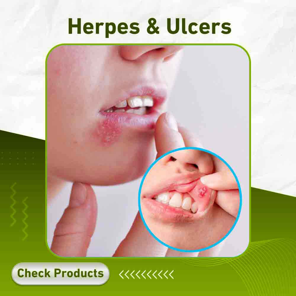 Herpes & Ulcers - Apotek Plus Pharmacy