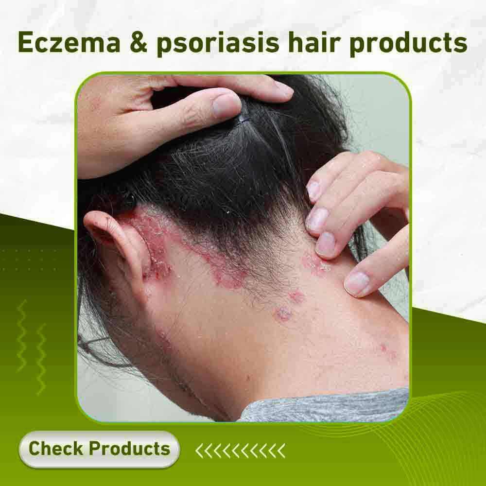 Eczema & psoriasis hair products - Apotek Plus Pharmacy