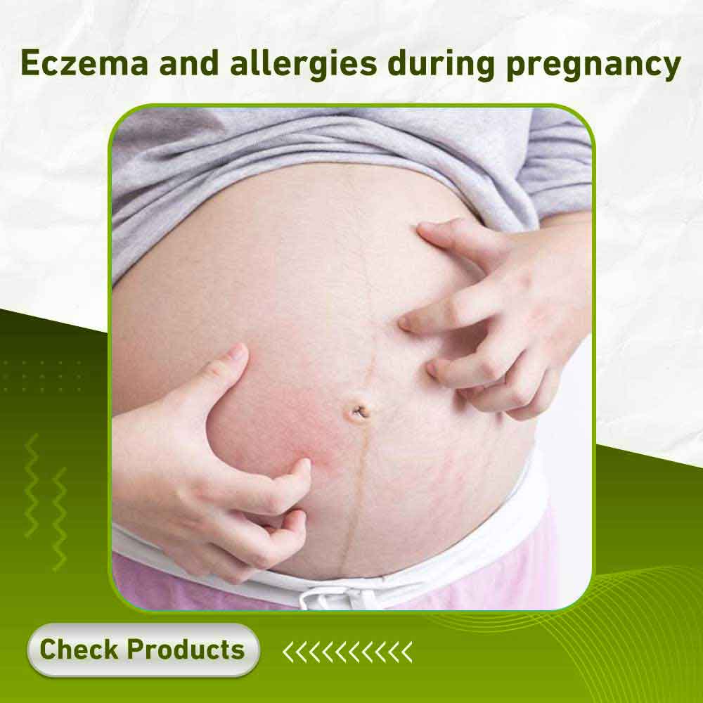 Eczema and allergies during pregnancy - Apotek Plus Pharmacy