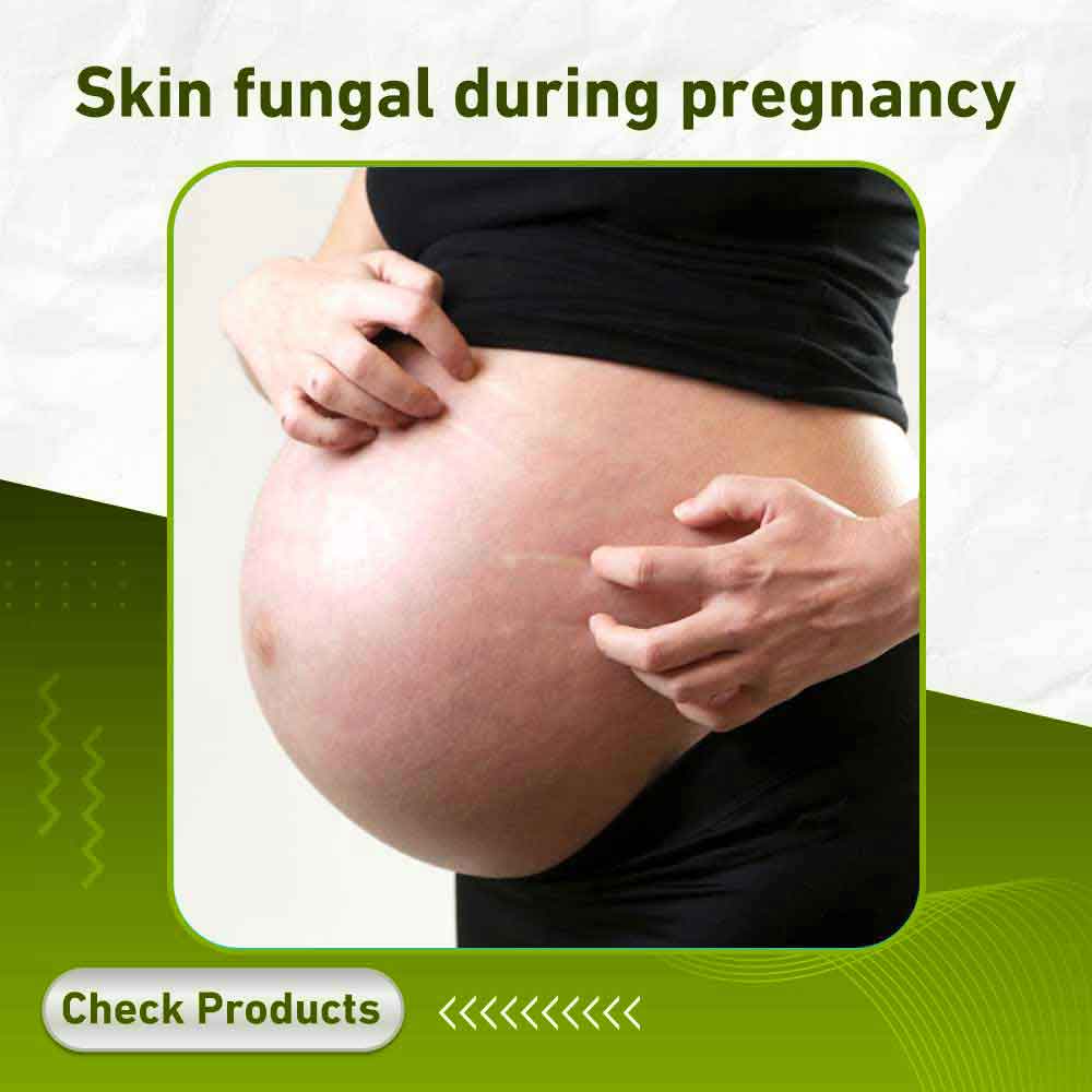 Skin fungal during pregnancy - Apotek Plus Pharmacy