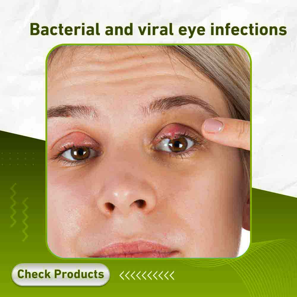 eye infections - Apotek Plus Pharmacy