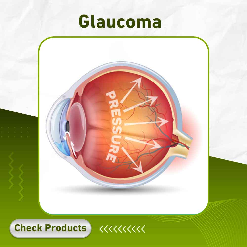 Glaucoma - Apotek Plus Pharmacy