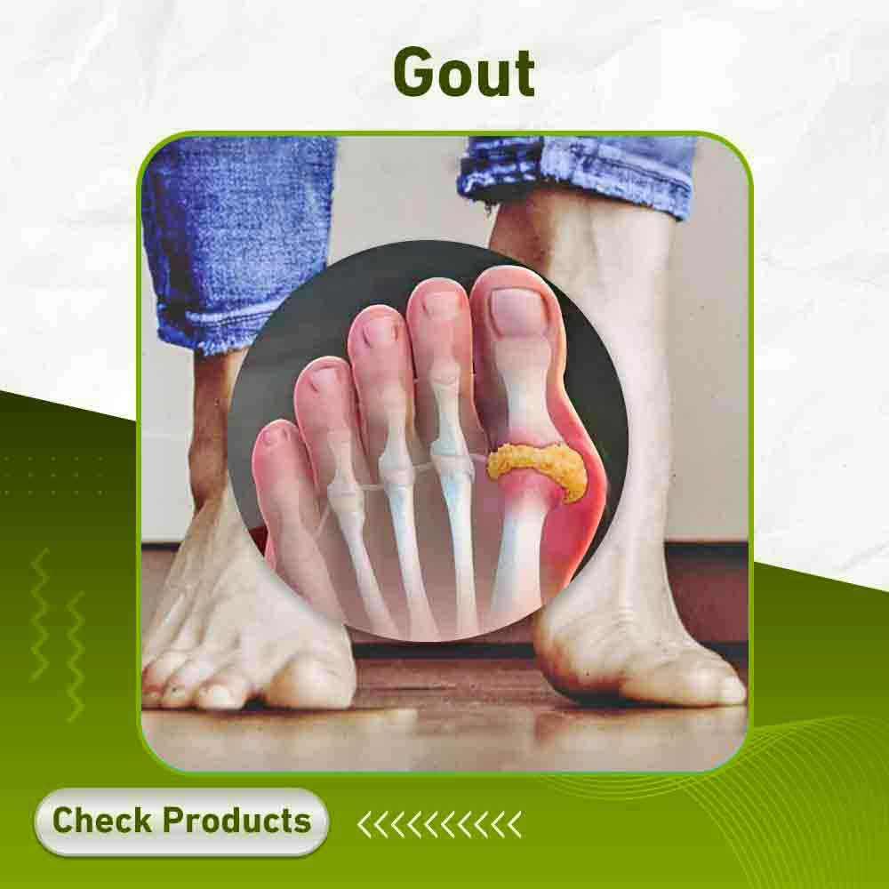 gout - Apotek Plus Pharmacy