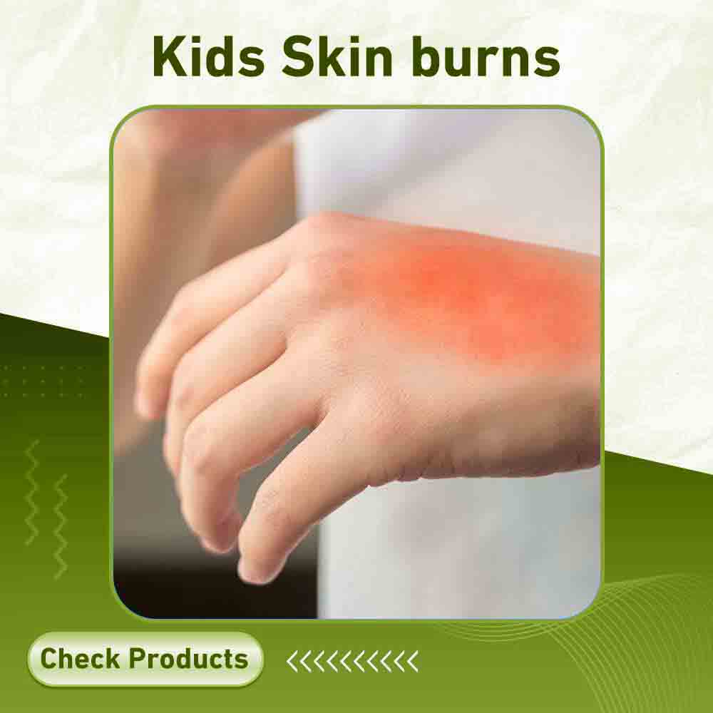 Kids Skin burns - Apotek Plus Pharmacy